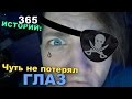 365 Историй: Чуть не потерял ГЛАЗ / Андрей Мартыненко