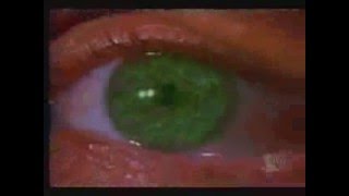 Smallville - Save me