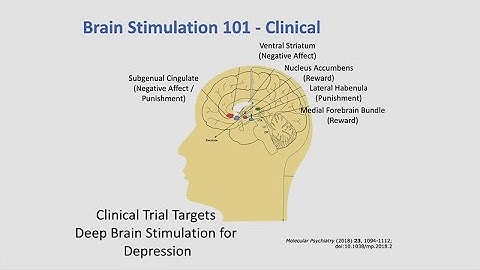 Neuroscience and Brain Stimulation with Dhakshin Ramanathan