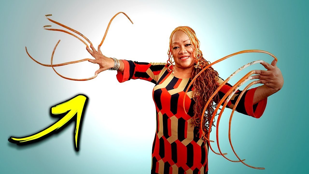 15 People With Strangely Unusual Body Features