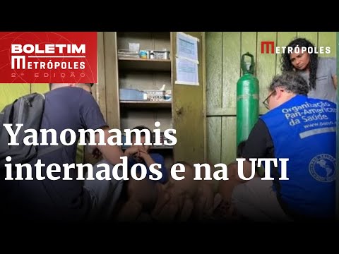 Crise Yanomami: 64 indígenas estão internados e 7 seguem na UTI | Boletim Metrópoles 2º