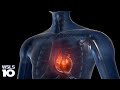Health watch  respiratory illness effects on the heart