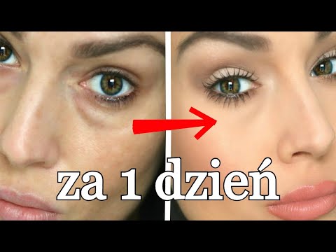 Wideo: Jak Radzić Sobie Z Zasinieniami Pod Oczami?