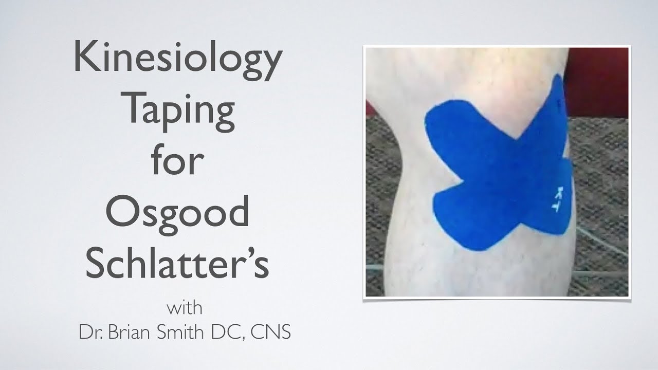 Kinesiology Taping Osgood Schlatters Dr Brian Smith Dc Chiropractor