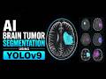 Brain Tumor Segmentation using YOLOv9 | Deep Learning Medical AI