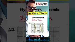 The De Winter T Wave