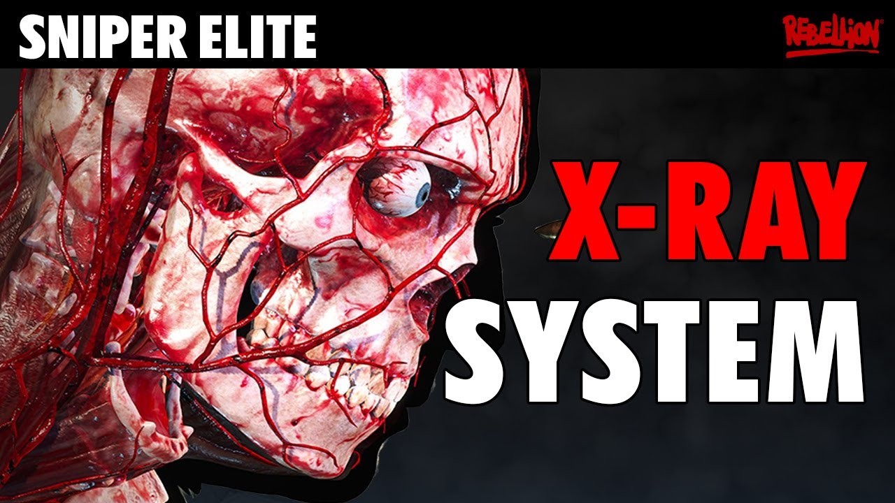 The Evolution of X-Ray in Sniper Elite!