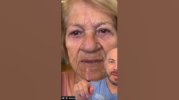 Thumbnail of You have to watch this amazing skin transformation! 🤯(Credit: @terezacardua on Tiktok) #trending