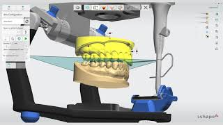 How To Get Started with 3Shape Splint Studio for Night Guards