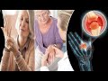 IF YOU HAVE Joint Pain OR Brain Fog OR Dental Problems you MUST WATCH this!