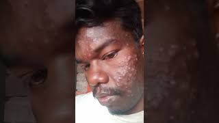 sabse best face wash and Jerry skin ki liye 👍muuchstac🙄anti acne gel  ,aloe ver. screenshot 3