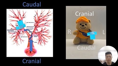 Airway Mapping Made Easy! (Bronchial Branch Tracing) LB6