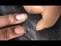 Comb and finger scratching on braids|NO TALKING|ASMR|HD1080p