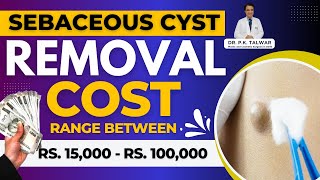 How Much Does Sebaceous Cyst Removal Cost? Sebaceous Cyst Removal Cost In Delhi | Dr. PK Talwar