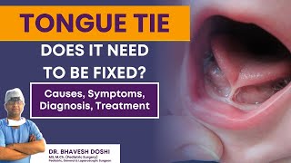 Tongue-Tie: What It Is and How It's Treated | Dr. Bhavesh Doshi | Pediatric Surgeon in Mumbai