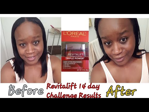 day-14-after|loreal-revitalift-14-day-challenge-|-results-|ms-nicole