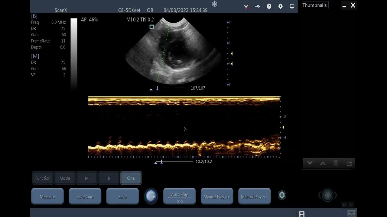 Using Mmode on the ScanX Ultrasound Machine YouTube