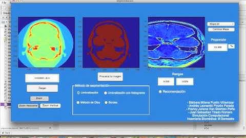 Procesamiento de imágenes- Simulación Computacional
