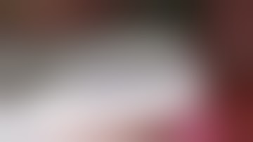 Uniportal VATS Pneumonectomy