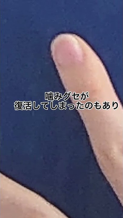 爪をかむ癖 Youtube