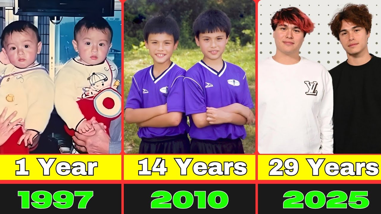 Преображение братьев-близнецов Стоукс | От 1 года до 29 лет