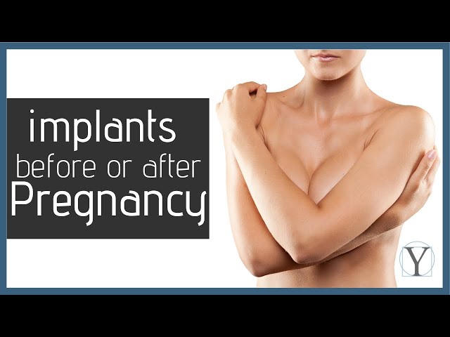 Breast Implants Before or After Pregnancy