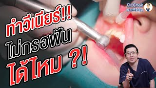 ทำไมทำวีเนียร์ ต้องกรอผิวฟัน เพราะอะไร ?!! | คลายปัญหารากฟันเทียมกับหมอโชค