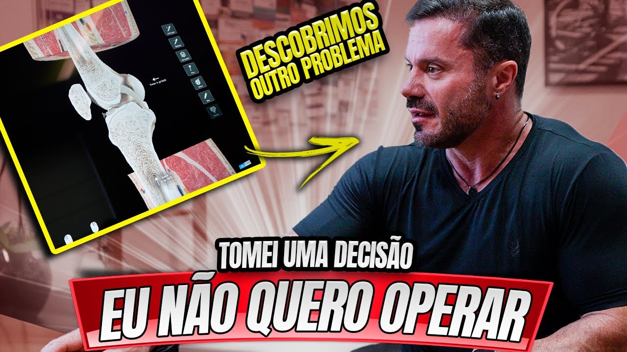 CARIANI NÃO QUER OPERAR – O MÉDICO ABRIU O JOGO