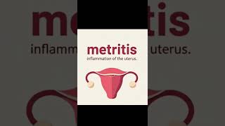 What does Metritis mean...#@Nk...MediMeanings
