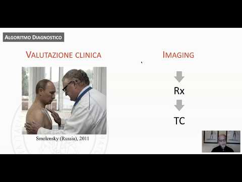 Video: L'incidenza E Le Tendenze Del Trattamento Delle Fratture Pediatriche Dell'omero Prossimale