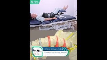 U60 chấm dứt cơn đau cổ vai gáy với phác đồ vật lí trị liệu không thuốc