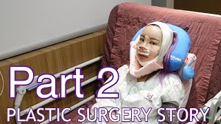 my plastic surgery story in korea part 2