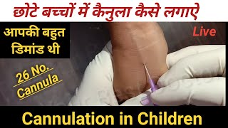 कैनुला लगाने का तरीका !! Cannulation procedure !! Cannula Insertion Technique