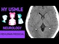 HY USMLE NEUROLOGY - #265