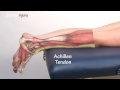 Achilles Tendonitis / Tendinopathy - Explained in 90 Seconds