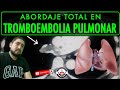 TROMBOEMBOLIA PULMONAR// ABORDAJE TOTAL BY DR. ZAMARRÓN