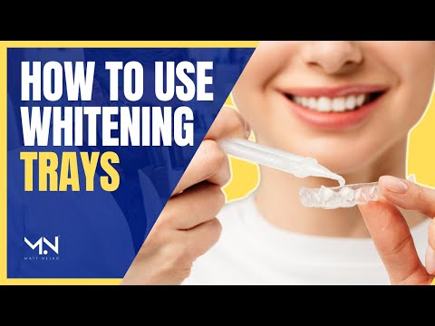 וִידֵאוֹ: כיצד להשתמש בנורית LED להלבנת שיניים בעזרת מגשי הלבנה