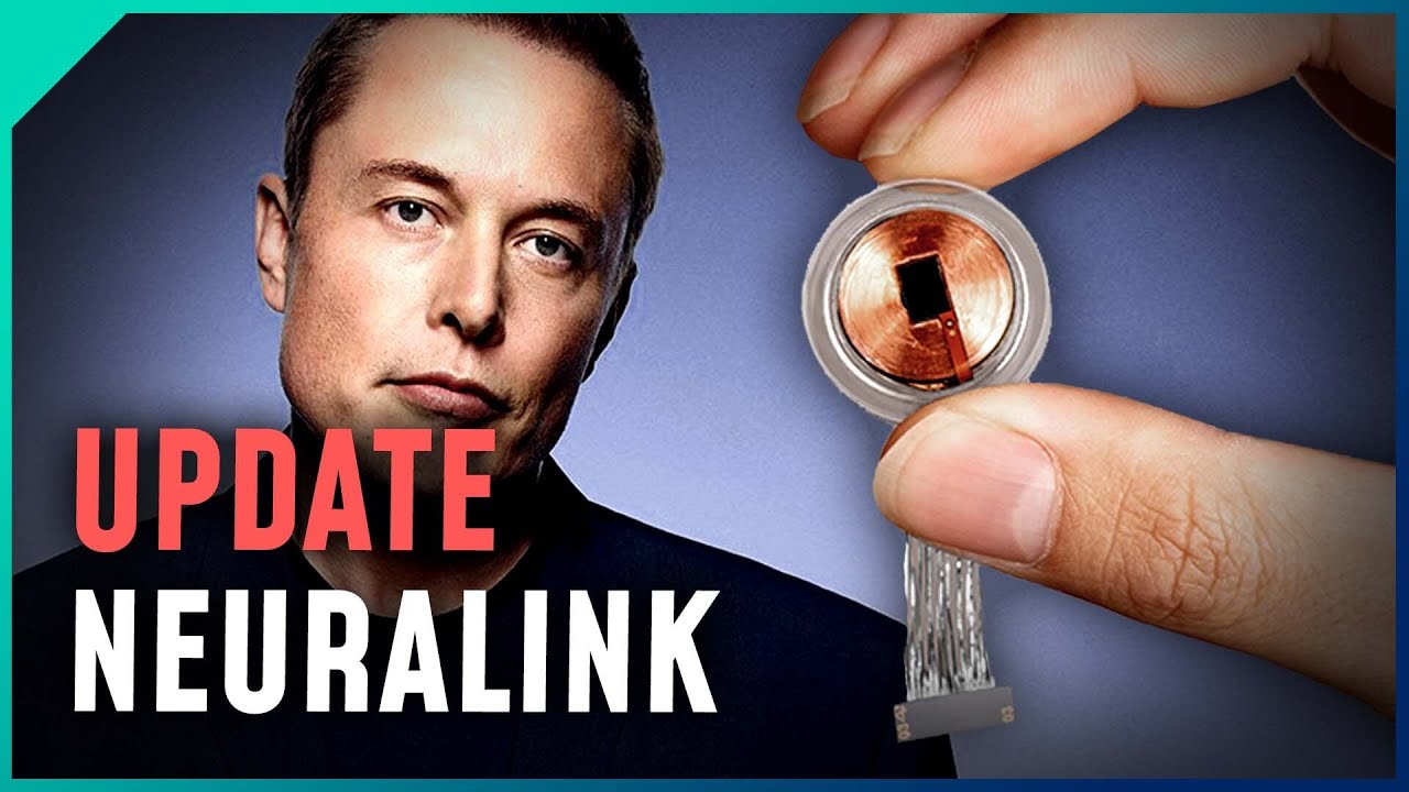  Update New Neues von Elon Musks Gehirn-Chip und was die Konkurrenz macht