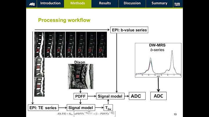 Michael Dieckmeyer : ADC Quantification of the Ver...
