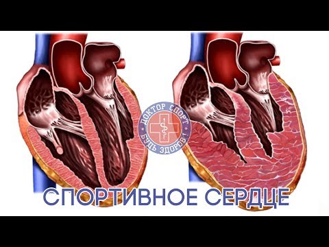 Доктор Спорт «Спортивное сердце»