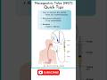 Nasogastric Tube (NGT)Quick Tips #trending #nurse #dactor #knowledge #medicine #science #nursing