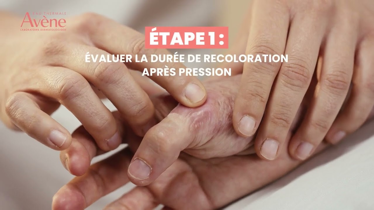 Tutoriel Massage Cicatriciel avec le Gel Cicatrice Remodelant Cicalfate+