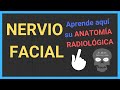 NERVIO FACIAL🤔: anatomía [TAC/RM]