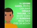 What Is Lassa Fever MSF Video Animation 