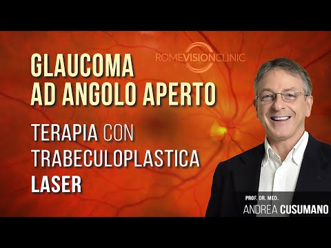 GLAUCOMA AD ANGOLO APERTO E TERAPIA CON TRABECULOPLASTICA LASER