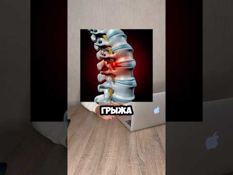 БОЛИТ СПИНА!ПОЧЕМУ?
