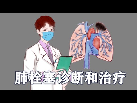 医学手绘| 肺栓塞的诊断方法和治疗