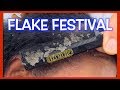 BEST OF PITAFLAKES VIDEO MONTAGE | OCTOBER 2018 | EXTREME DANDRUFF | SEBORRHEIC DERMATITIS