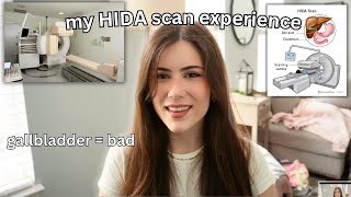 My HIDA Scan Experience (i need my gallbladder taken out😪)