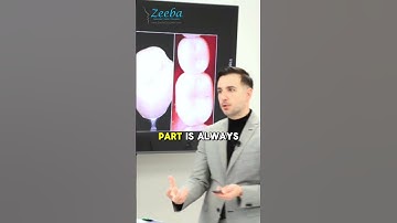 Avoid Excess Cement in Implant Restorations | Screw-Retained & Cementation Tips